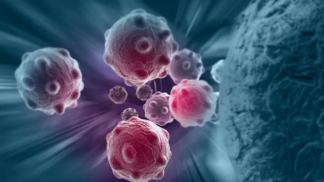 Cancer Cell：许琛琦/宋宝亮团队全面绘制肿瘤胆固醇代谢图谱，提升CAR-T治疗实体瘤效果