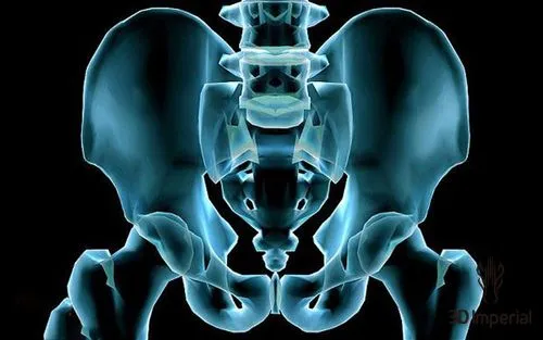 Investigative Radiology:锡滤过技术，实现骨盆CT的低剂量成像！