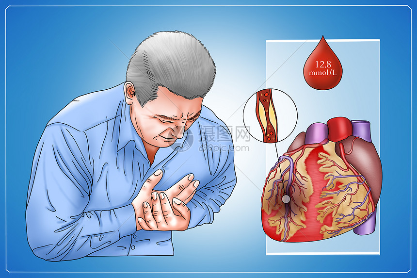 BMC Cardiovasc Disord：急性冠脉综合征后糖尿病患者血脂目标<font color="red">达标率</font>
