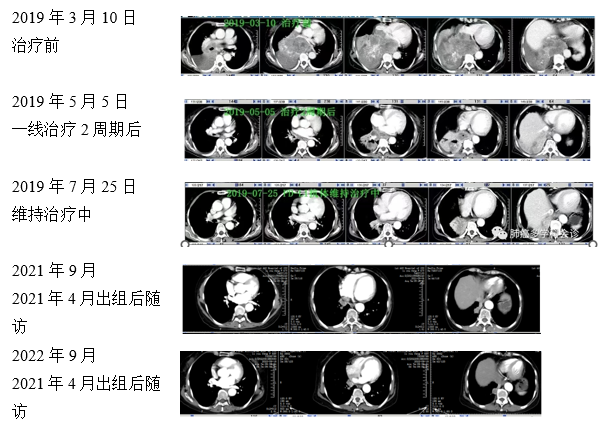 疗效可靠 安全无忧丨国产原研PD-L1抑制剂阿得贝利单抗显著改善<font color="red">广泛</font><font color="red">期</font><font color="red">SCLC</font>患者生存，疗效与安全双优+