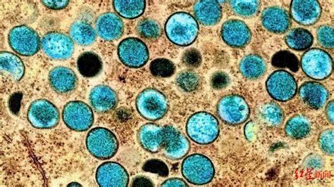 Lancet Infect Dis：MPOX疫苗与人类感染的免疫信号