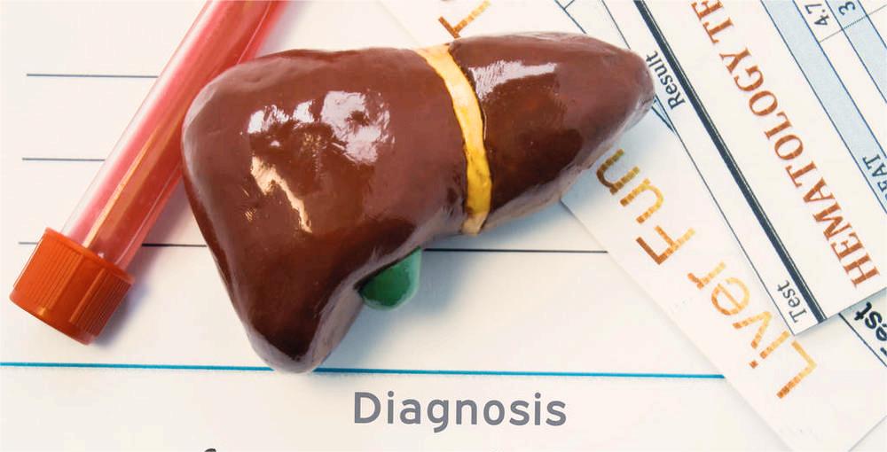 J Ethnopharmacol：人参皂苷Rg1通过激活SIRT1抑制肝脏炎症和氧化<font color="red">应激</font>，减轻ANIT诱导的胆汁淤积性肝损伤