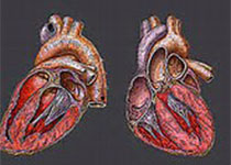 Circulation-Heart Failure：肥胖改变右室功能障碍患者的临床结局