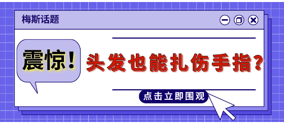 <font color="red">头发</font>也能扎伤手指？