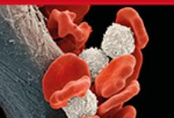 期刊<font color="red">推荐</font>《Therapeutic Advances in Hematology》