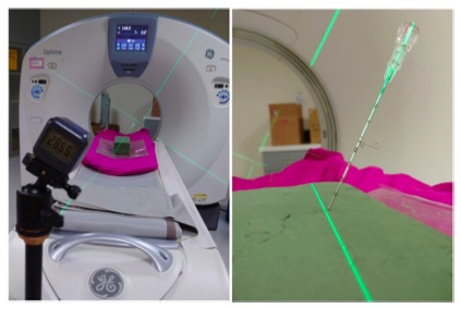 European Radiology：IMU在经皮CT引导下穿刺中的应用