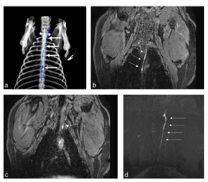 European Radiology：淋巴结的动态增强CT淋巴管造影和动态增强MR淋巴管造影