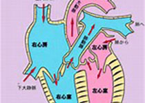 JAHA：大动脉粥<font color="red">样</font>硬<font color="red">化性</font>卒中患者<font color="red">纤维</font>蛋白原与白蛋白比值与临床结局的关系