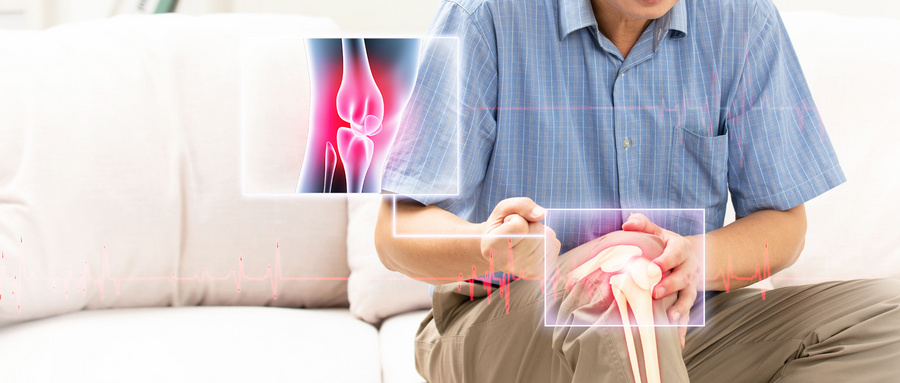 Arthritis Rheumatol：适度减重对膝关节与髋关节骨关节炎患者的生存益处：一项基于减肥药物干预的研究