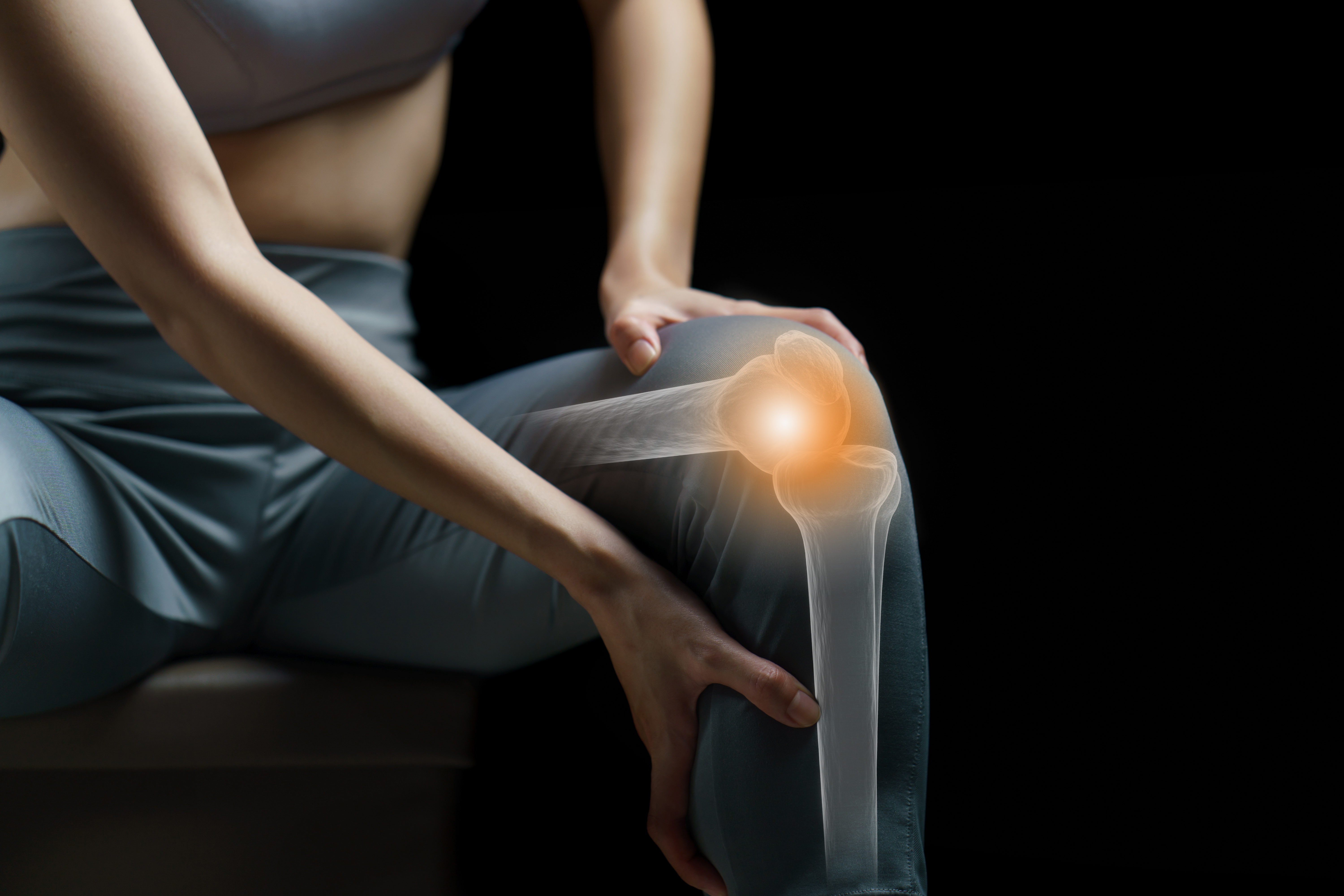 Rheumatol Int：平衡训练在膝骨关节炎患者中的疗效