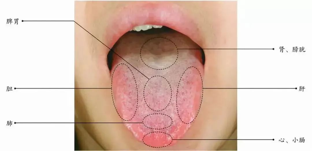 中医舌诊：常见体质舌诊解析（欢迎收藏）
