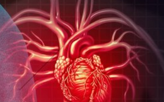Eur Heart J：经皮冠状动脉介入术后围手术期心肌梗死与长期死亡率
