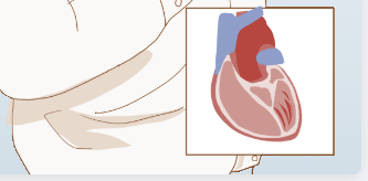 Eur Heart J ：B 型<font color="red">利尿</font>钠肽水平可预测大量患有先天性心脏病的成年人的长期死亡率