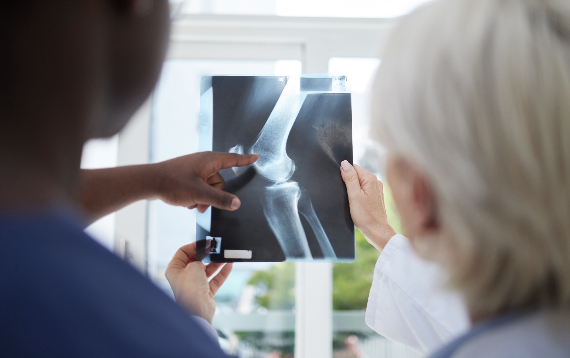 Geriatr Orthop Surg Rehabil：80岁以上桡骨远端骨折患者的一年死亡率研究