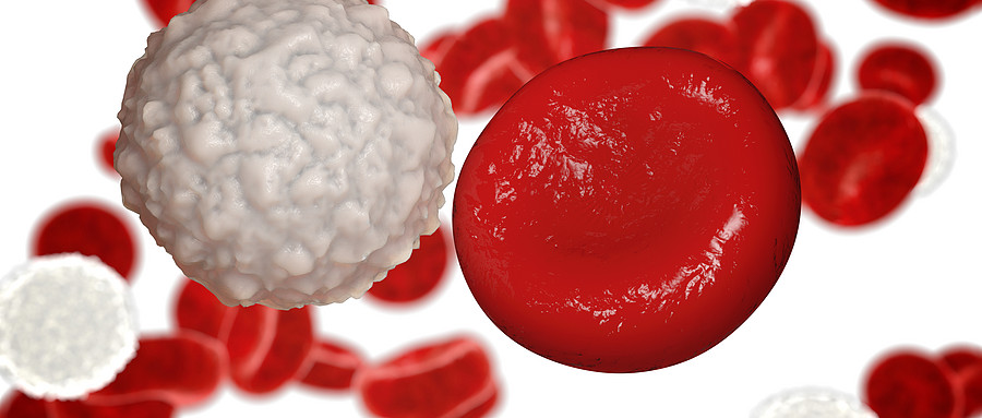 【Blood】CAR-T治疗WM组织学转化的<font color="red">LBCL</font>高度有效