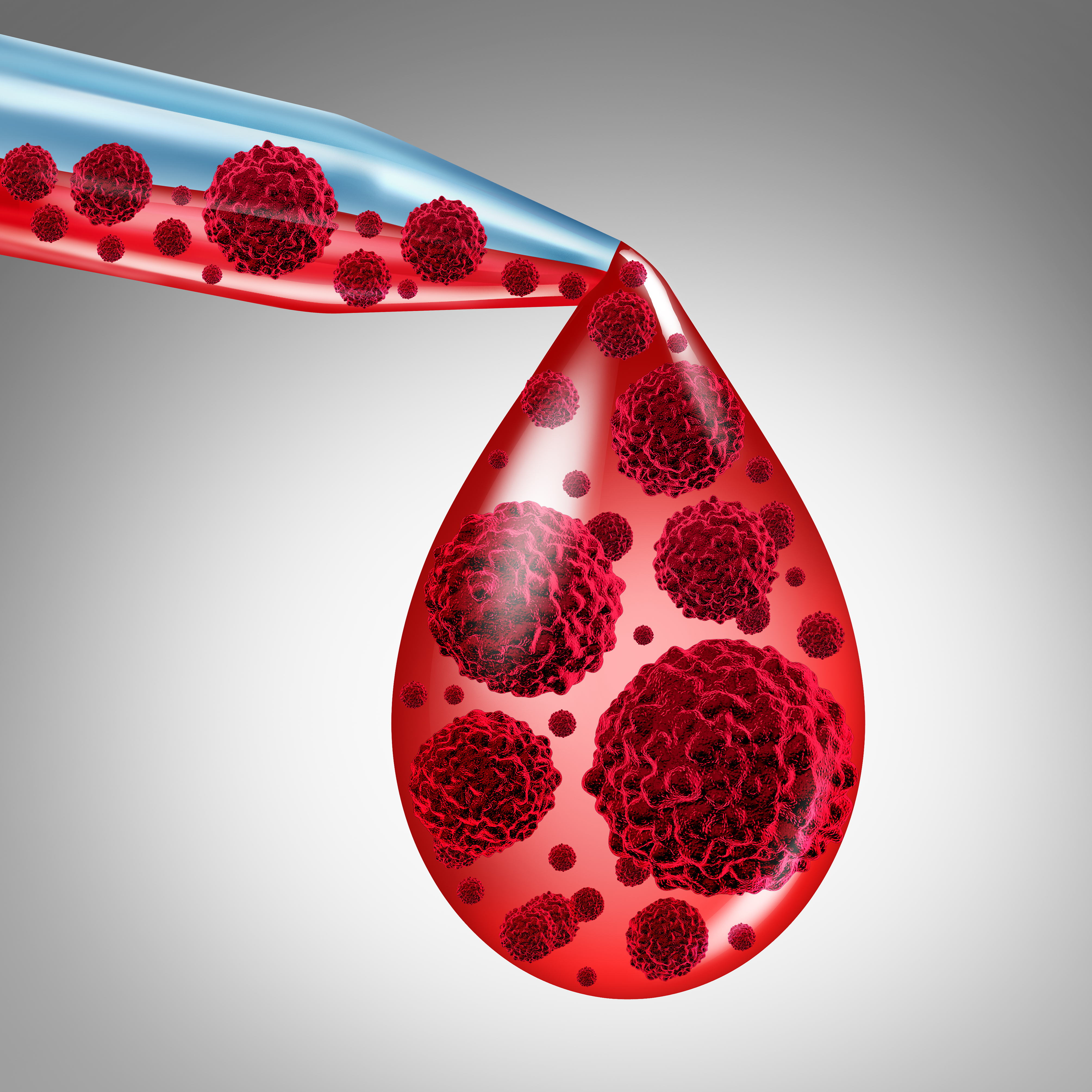 【柳叶刀-血液学】EBMT专家共识：异基因造血干细胞移植后的供者淋巴细胞输注