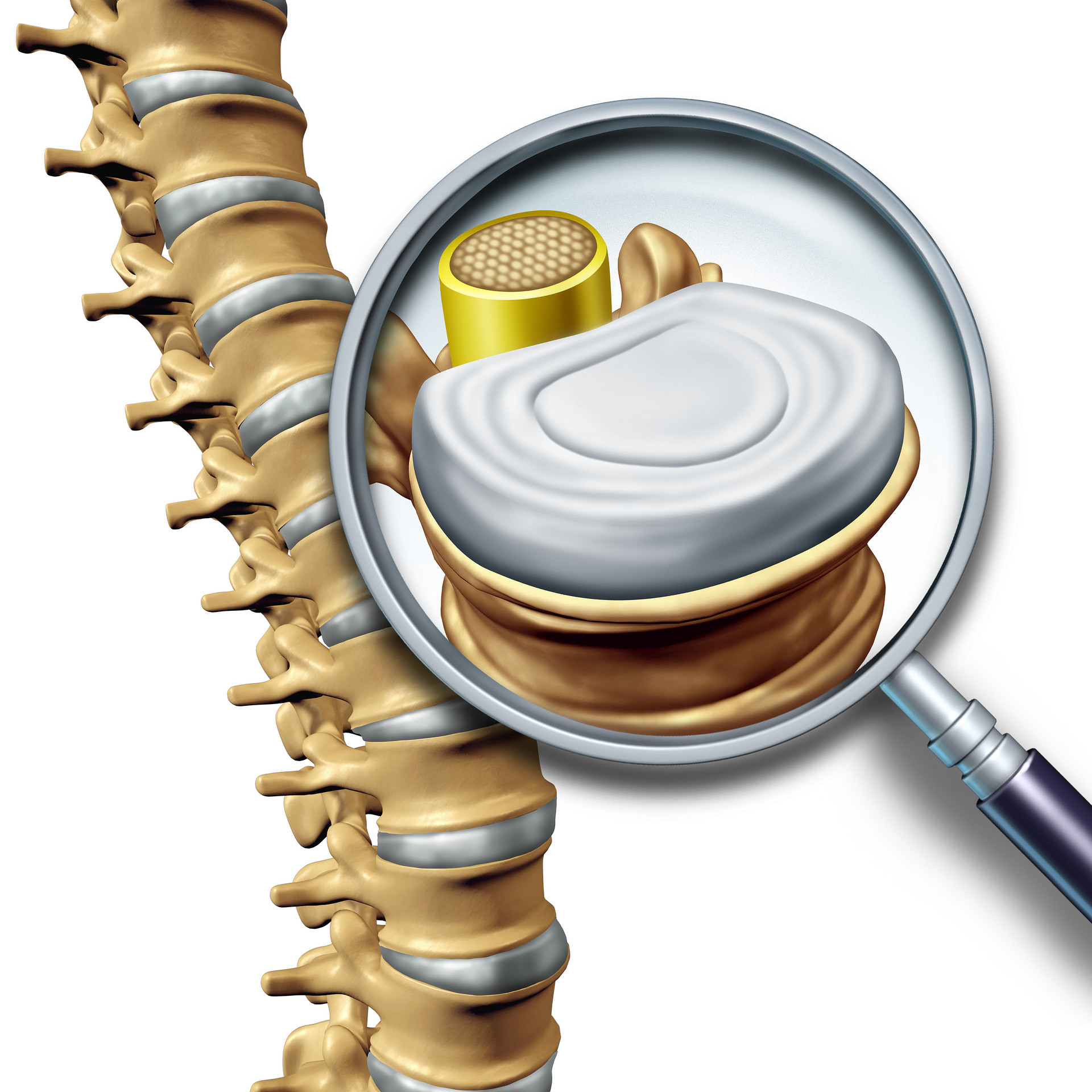 European Radiology：EOS x线片上基于深度学习的脊柱生长潜力识别