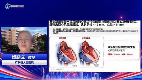 《左心室肥厚诊断和治疗临床路径中国专家共识2023》解读