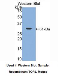 https://msimg.bioon.com/bionline/goods-no-pic.png