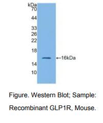 小鼠胰高血糖素样肽1受体(GLP1R)多克隆抗体