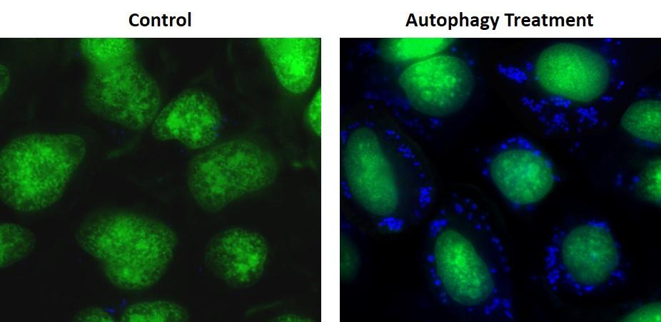 https://img.medsci.cn/e73eefcea40976357f460123cbf1e819c54e5106c9b457225be13b1cbc991aff.png