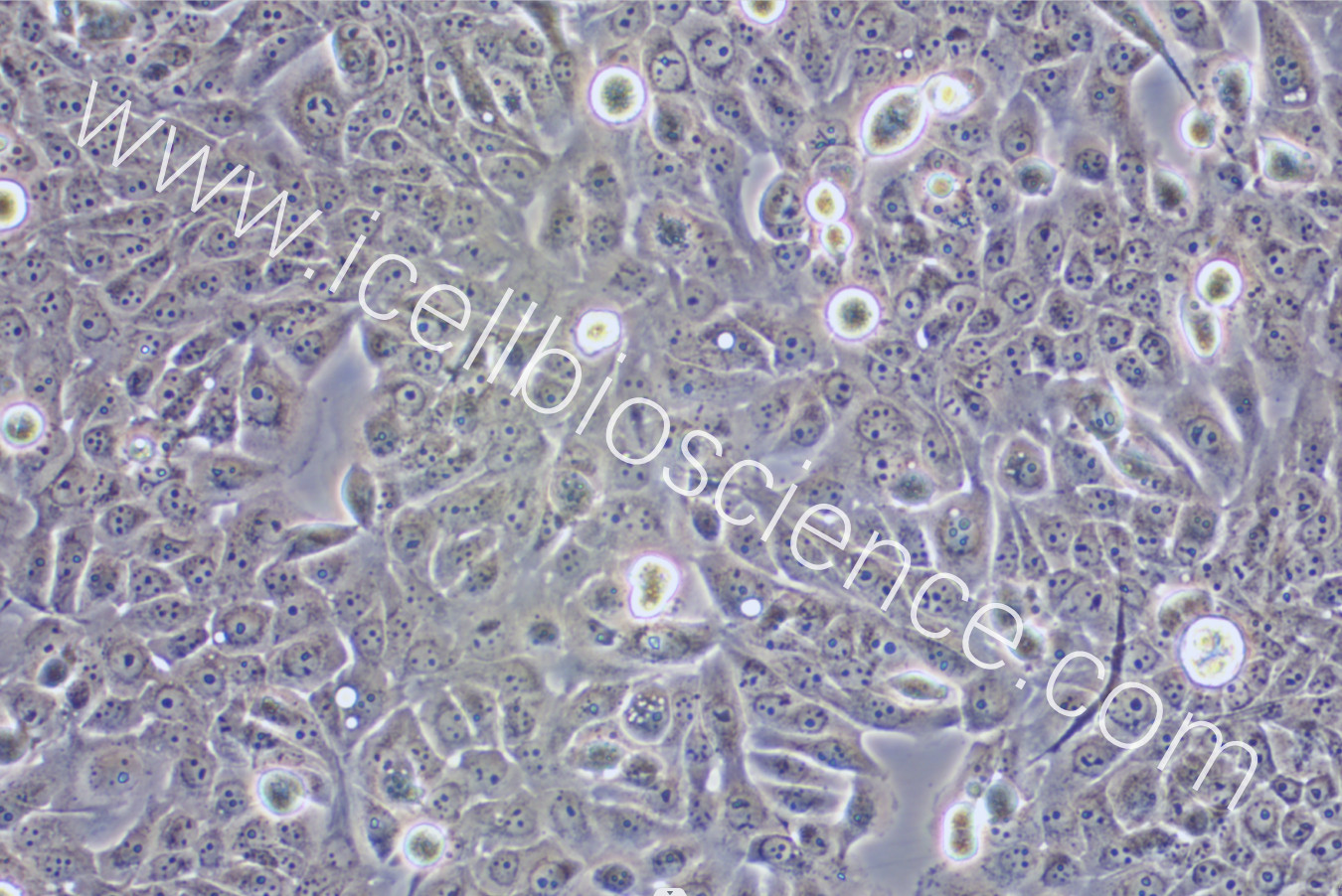 JIMT-1细胞/JIMT1细胞/JIMT-1/JIMT1/人乳腺癌细胞