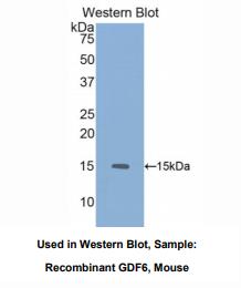 https://msimg.bioon.com/bionline/goods-no-pic.png