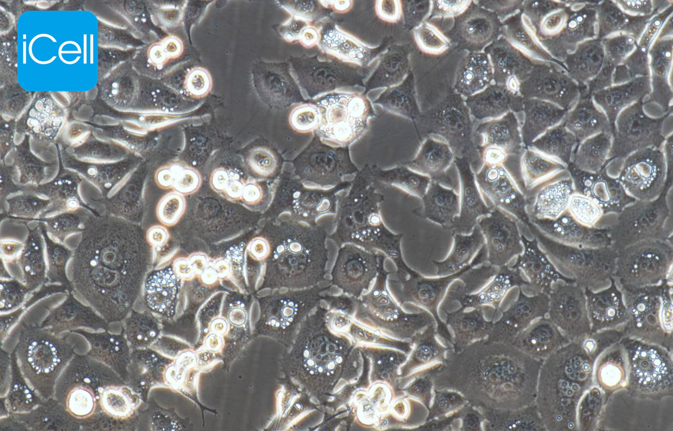 kyse30细胞/kyse-30细胞/kyse-30/kyse30/人食道癌细胞