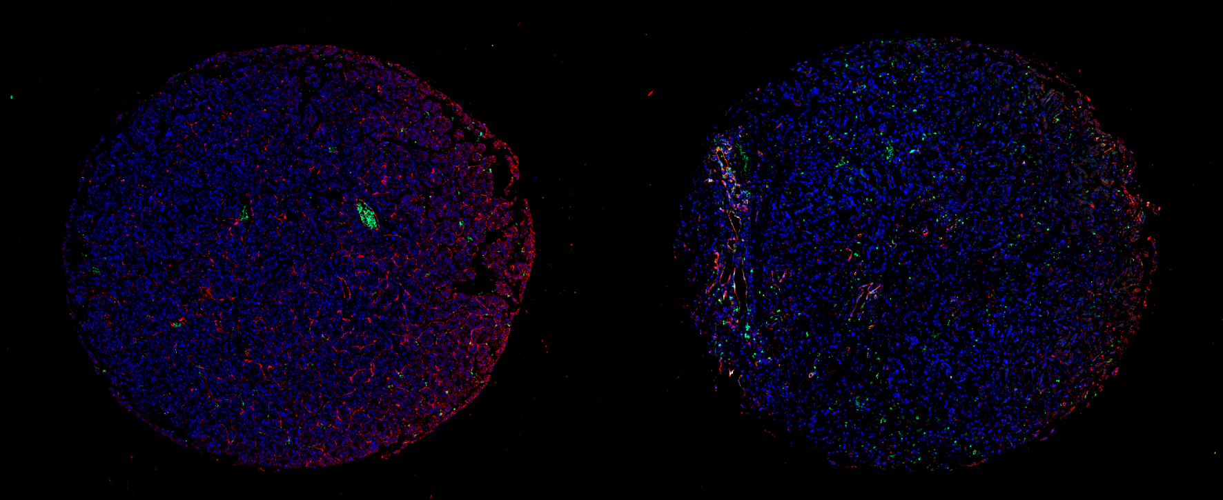 https://img.medsci.cn/09f7f9b396aaea8c5a2398de56f920980d508f8e7313325b130eae0a6c633bd4.png