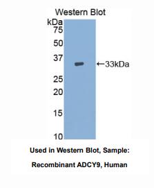 人腺苷酸环化酶9(ADCY9)多克隆抗体