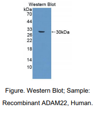 人解整合素金属蛋白酶22(ADAM22)多克隆抗体