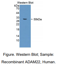 https://msimg.bioon.com/bionline/goods-no-pic.png