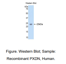 人过氧蛋白同源物(PXDN)多克隆抗体