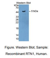 https://msimg.bioon.com/bionline/goods-no-pic.png