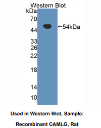 https://msimg.bioon.com/bionline/goods-no-pic.png