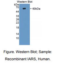 人异亮氨酰tRNA合成酶(IARS)多克隆抗体