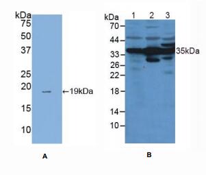 人膜联蛋白A4(ANXA4)多克隆抗体