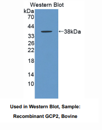 https://msimg.bioon.com/bionline/goods-no-pic.png