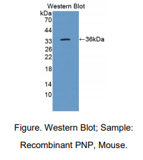 https://msimg.bioon.com/bionline/goods-no-pic.png