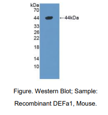 https://msimg.bioon.com/bionline/goods-no-pic.png