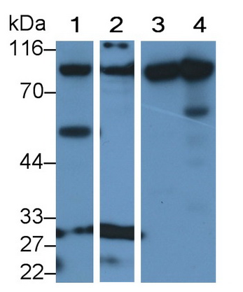 人泛素样修饰激活酶2(UBA2)多克隆抗体