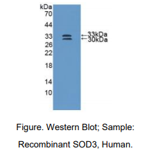 https://msimg.bioon.com/bionline/goods-no-pic.png