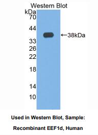 人真核翻译延伸因子1δ(EEF1d)多克隆抗体