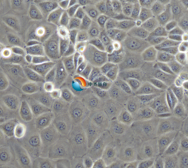 人卵巢癌细胞NIH:OVCAR-3