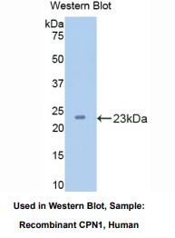 人羧肽酶N1(CPN1)多克隆抗体