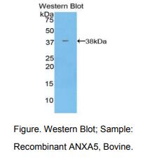 牛膜联蛋白A5(ANXA5)多克隆抗体