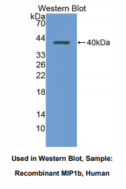 人巨噬细胞炎性蛋白1β(MIP1b)多克隆抗体