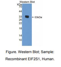 人真核翻译起始因子2亚基1(EIF2S1)多克隆抗体