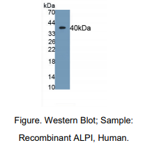 人肠碱性磷酸酶(ALPI)多克隆抗体