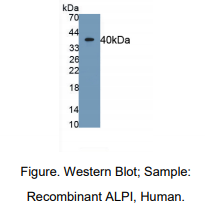 https://msimg.bioon.com/bionline/goods-no-pic.png